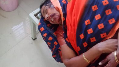 Photo of गाजीपुर:दबंग कोटेदार ने विधवा महिला को लाठी,डंडे और ईट से मारकर किया घायल